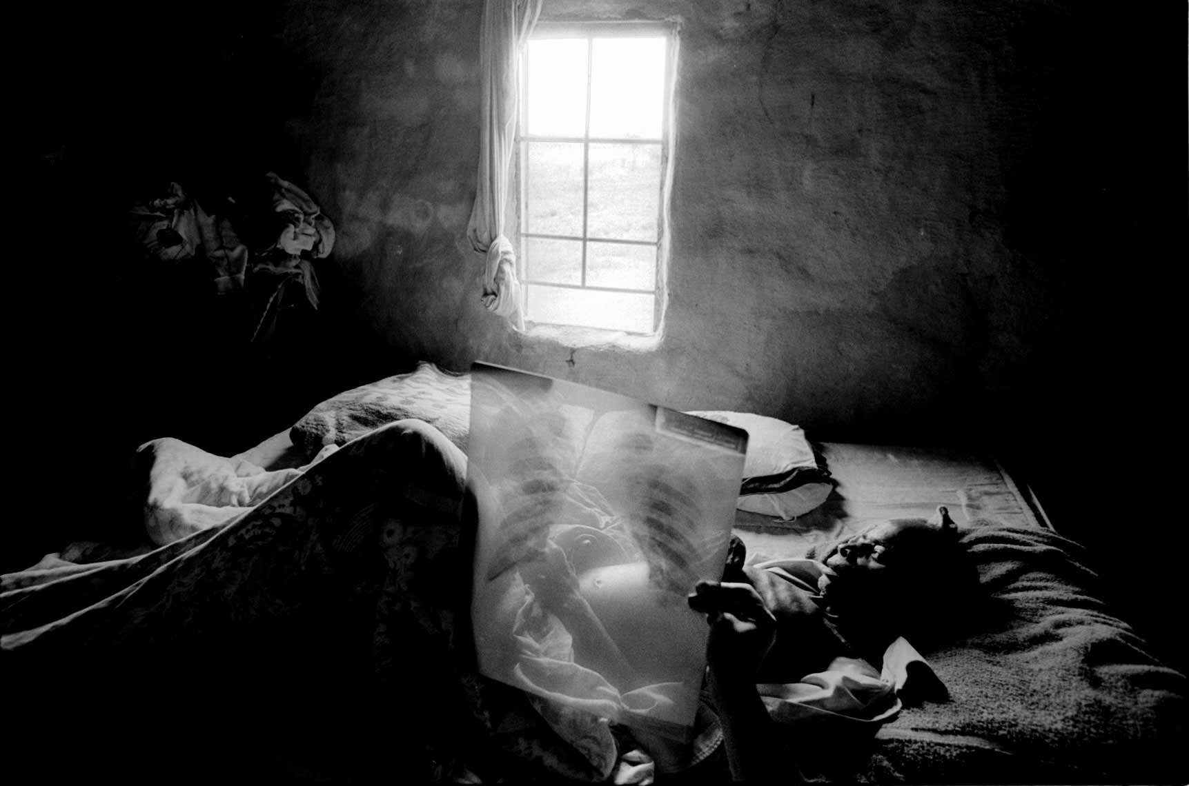 AIDS-I-ZAMBIA-07